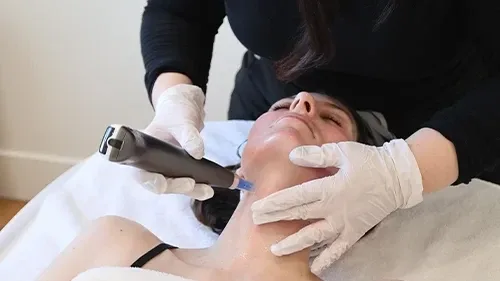 Best Treatment for Acne Scars: Custom Resurfacing vs Microneedling vs Chemical Peels