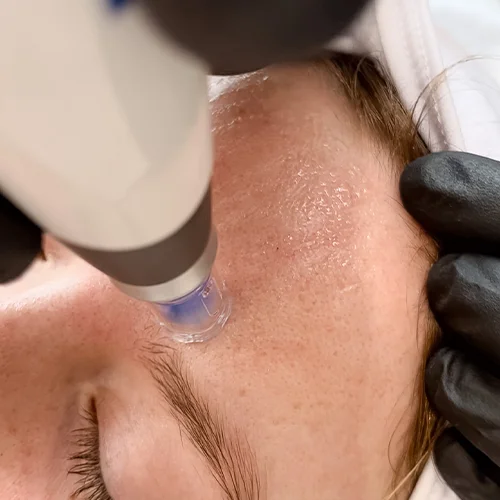 The Power and Importance of Medical-Grade Facials