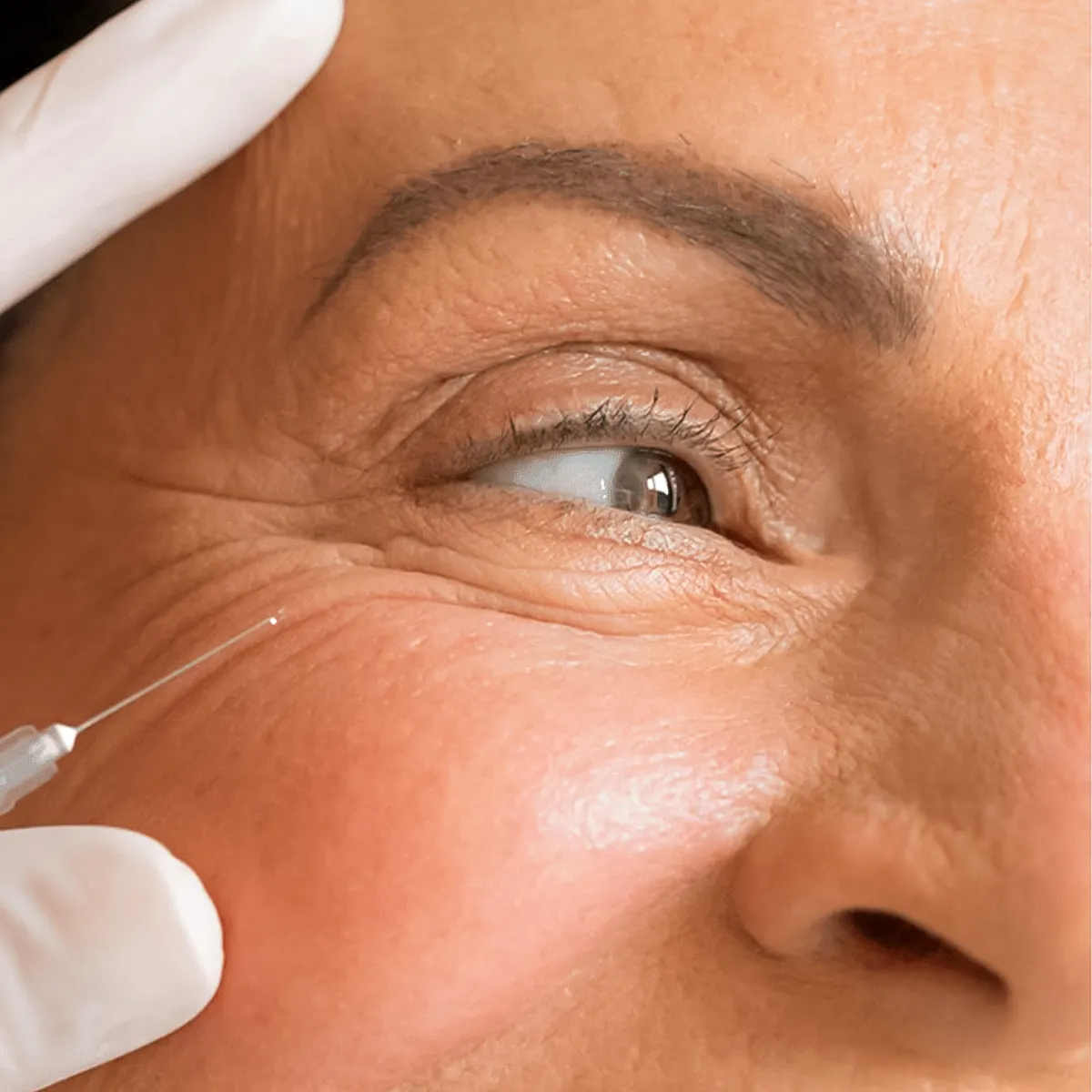 understanding wrinkles and aging 3