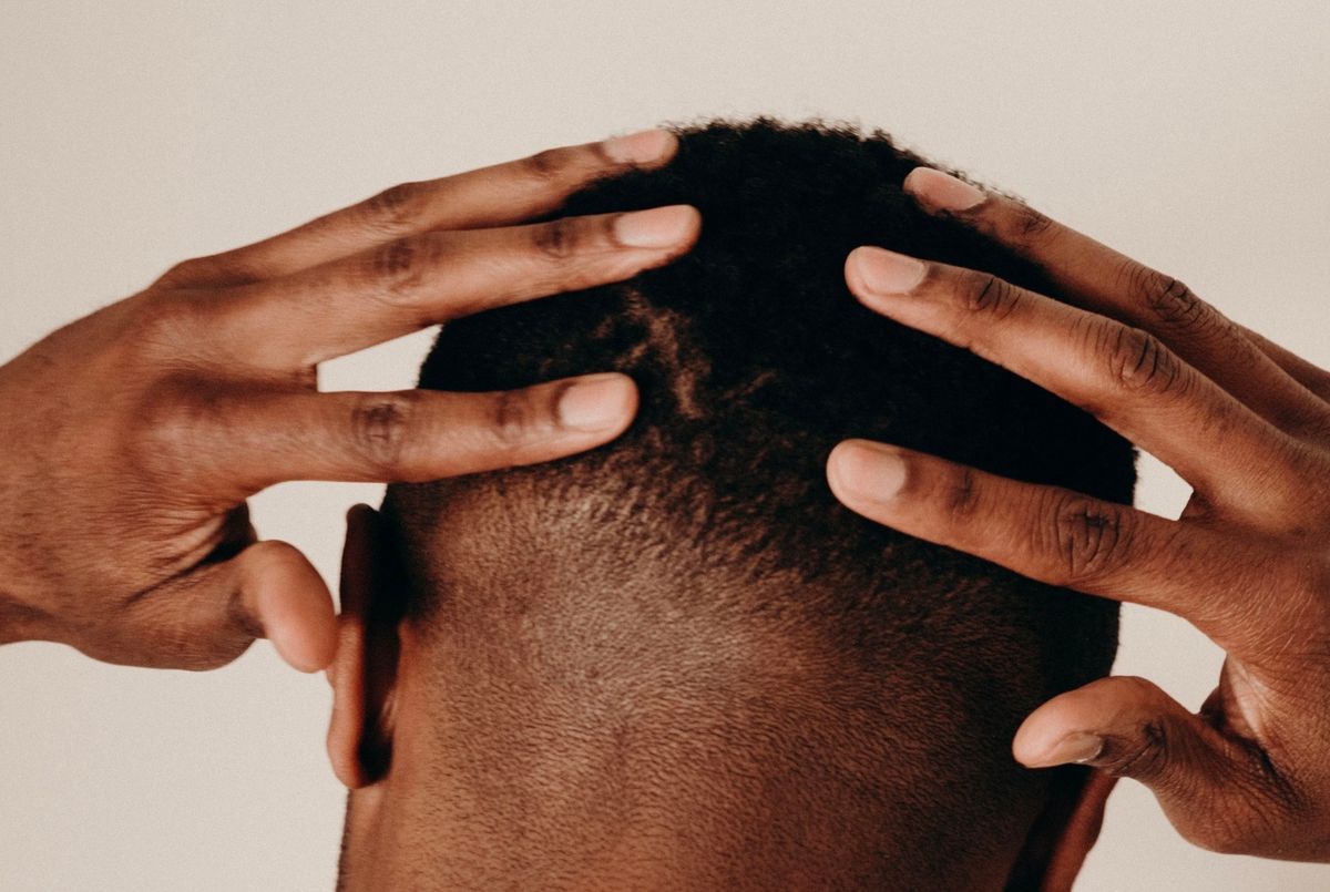 Hair Loss and Thinning Hair — in clinic