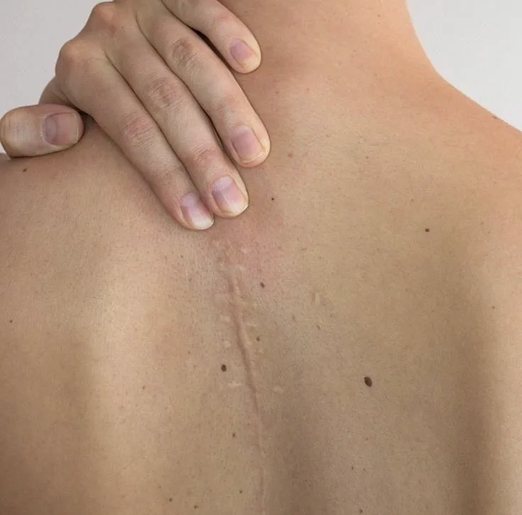 Body — in clinic