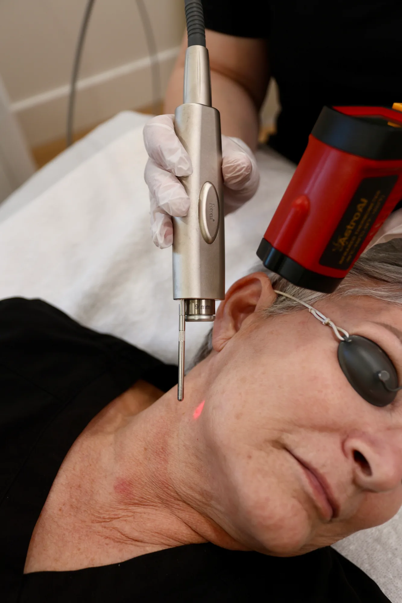 Laser — in clinic