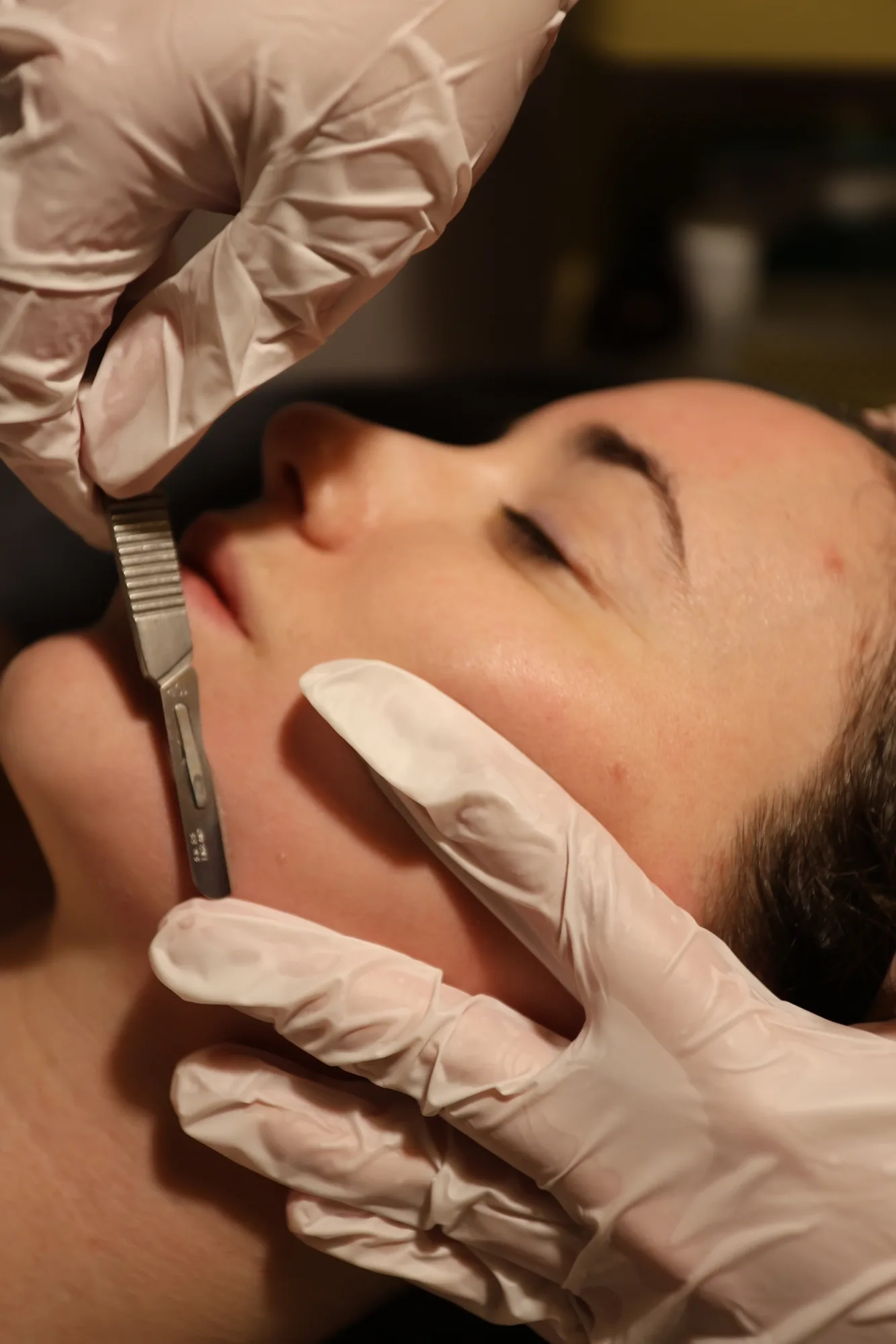 Dermaplaning Facial — treatment