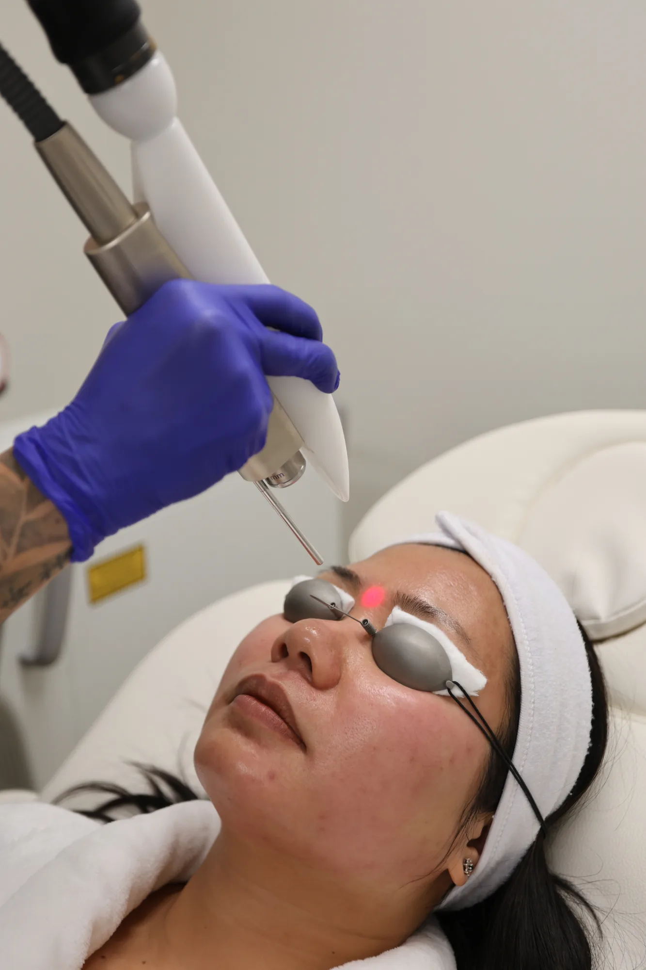 Custom Resurfacing — treatment