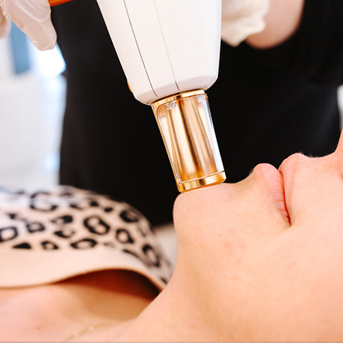 ResurFX — treatment
